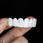Removable Dental Veneers | Natural-Looking White Veneers | Adjustable & Reusable | Comfortable Fit