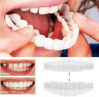 Removable Smile Veneers Set | Thin Realistic Acrylic Design | Upper & Lower Set with Molds