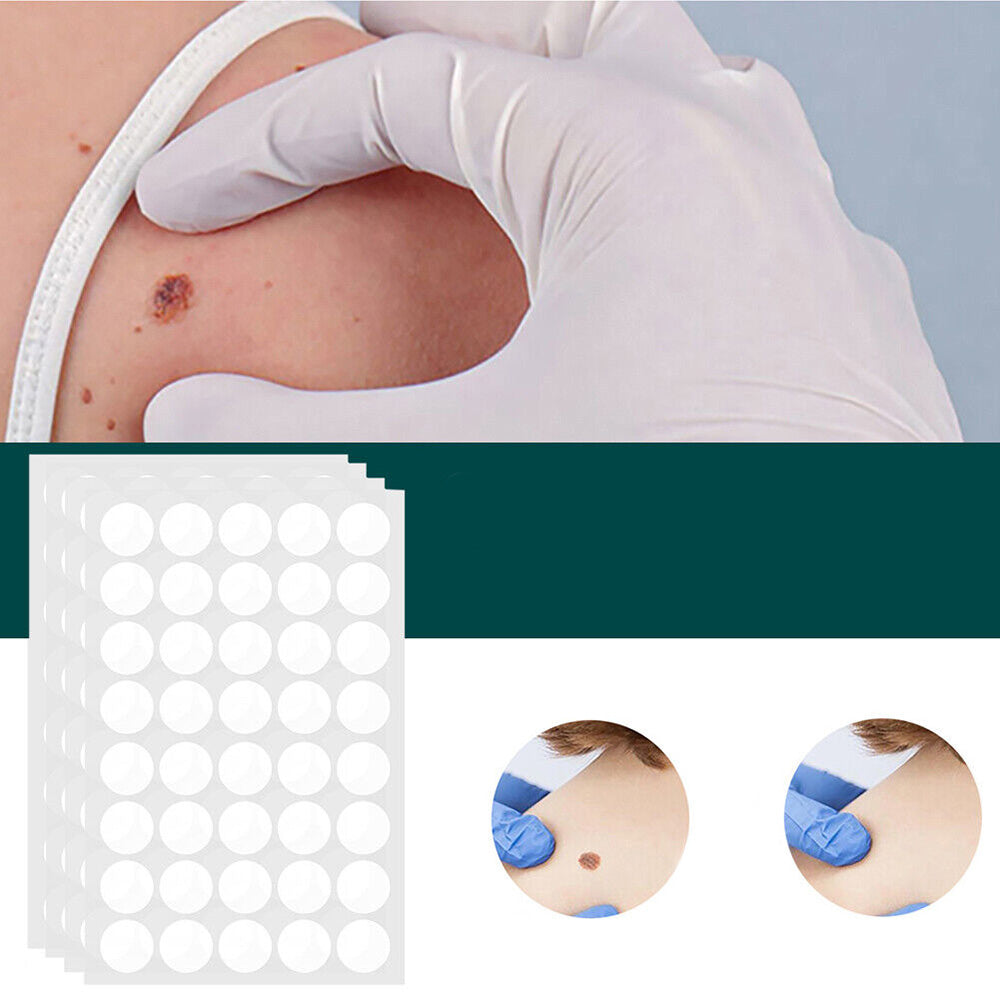 Skin Tag Patches | Hydrocolloid Plasters | 120 Count | Hypoallergenic Matte Finish