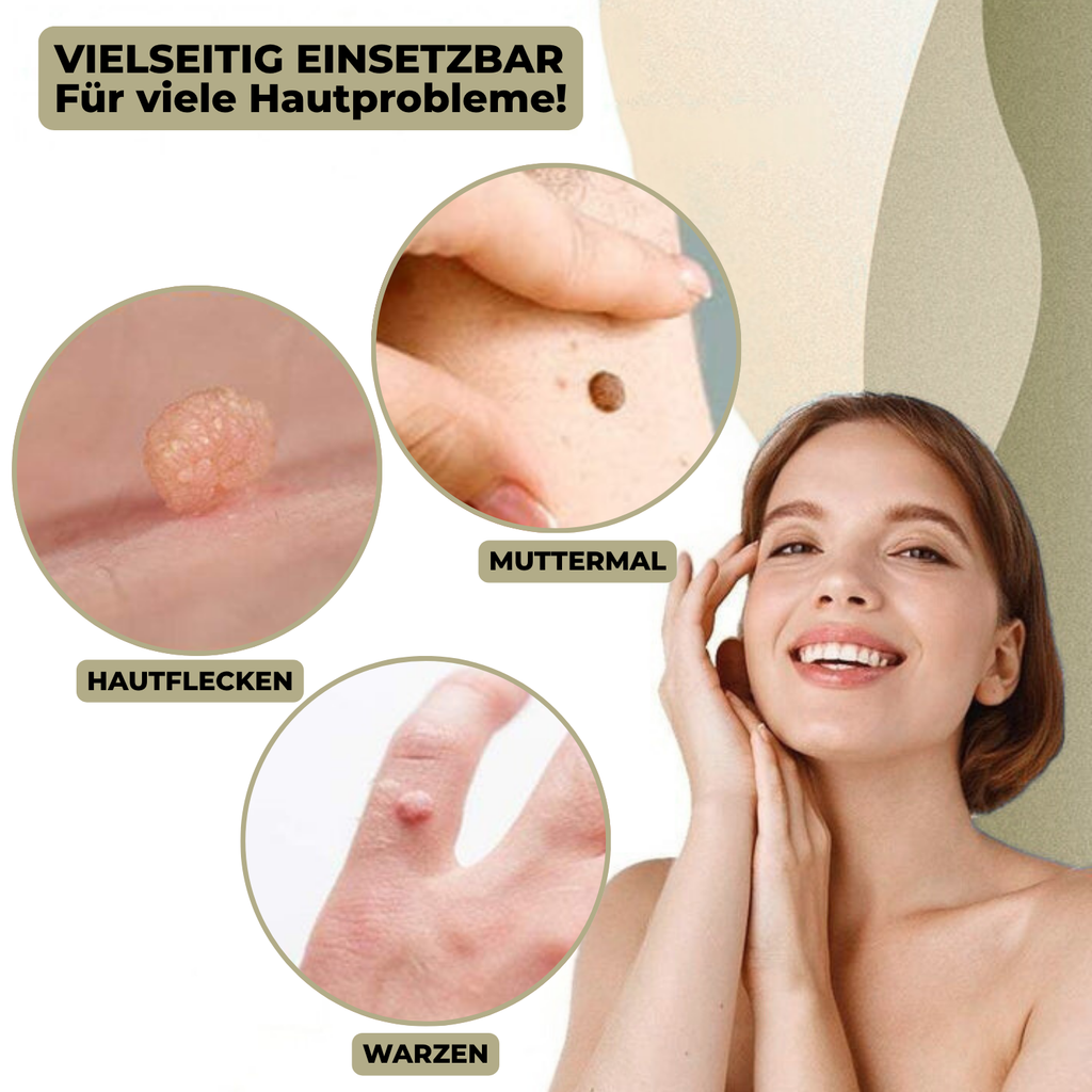 Wart & Mole Remover | Painless Non-Surgical Treatment | Skin-Friendly Formula | At-Home Use