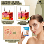 Wart & Mole Remover | Painless Non-Surgical Treatment | Skin-Friendly Formula | At-Home Use
