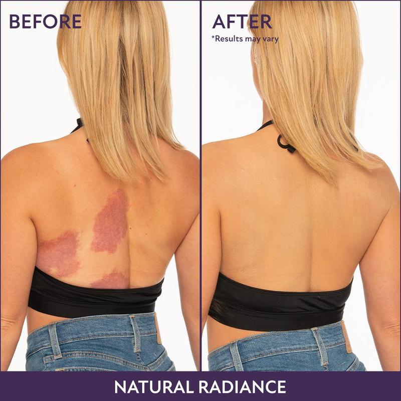 LumaSkin™ — Reveal Your Perfectly Flawless, All-Day Radiance