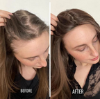 RadiantRoot™ — Wake Dormant Follicles and Revel in Thick, Silky Hair That Commands Attention