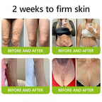 VelaBloom™ — Unleash Youthful Radiance with a Visible Lift in Just Days
