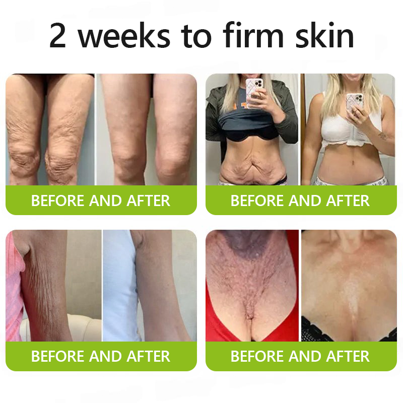 VelaBloom™ — Unleash Youthful Radiance with a Visible Lift in Just Days