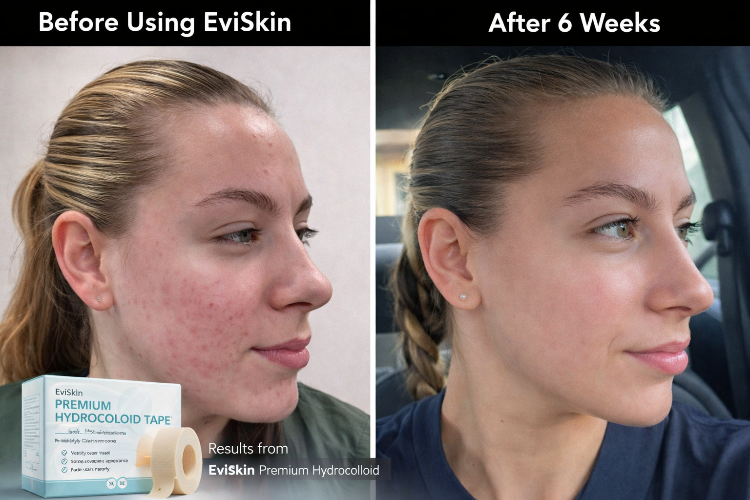 PureAura™ — Destroy Breakouts Fast and Shine with Unstoppable Confidence