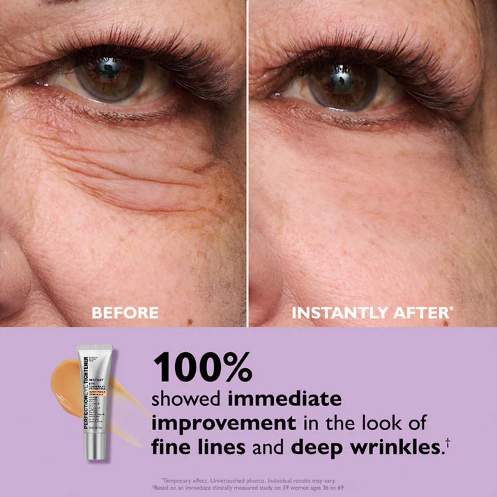 VitaLift™ — Instantly Vanish Eye Bags and Wrinkles for Unstoppable Confidence