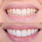 Brillique™ — Effortless Brightness That Boosts Your Confidence Instantly