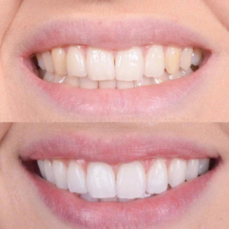 Brillique™ — Effortless Brightness That Boosts Your Confidence Instantly