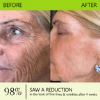 VelaBloom™ — Unleash Youthful Radiance with a Visible Lift in Just Days