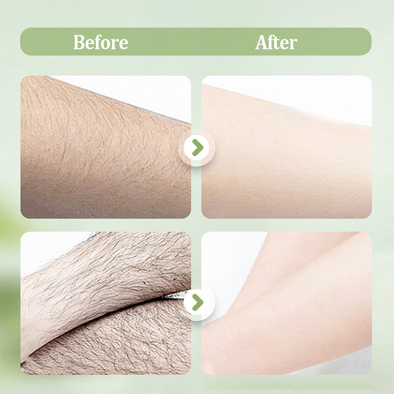 SensaSilk™ — Unlock Pain-Free, Silky Smooth Skin That Turns Heads Instantly