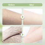 SensaSilk™ — Unlock Pain-Free, Silky Smooth Skin That Turns Heads Instantly