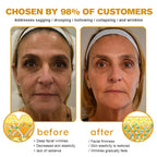 VitaLuxe Radiance™ — Unleash Youthful Glow and Firmness That Commands Attention Every Day