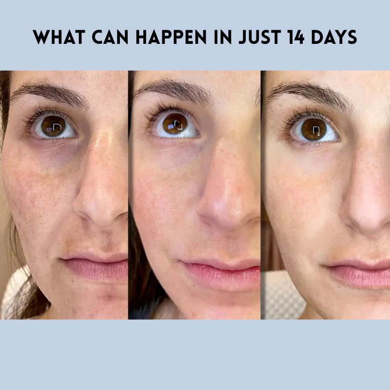 RevitaTrace™ — Instantly Lift and Revive Your Skin for a Youthful, Radiant Glow