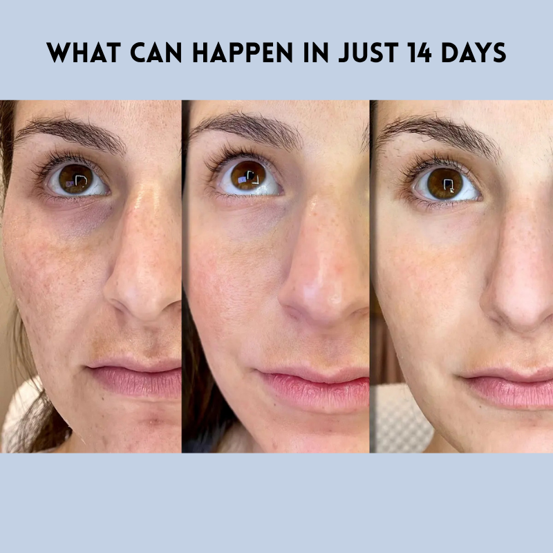 LumaLift™ — Instantly Revive Your Glow with a Featherlight, Youthful Lift