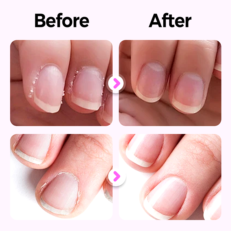 LumeNail™ — Unlock Instant Strength, Shine, and Irresistible Scent for Nails That Wow
