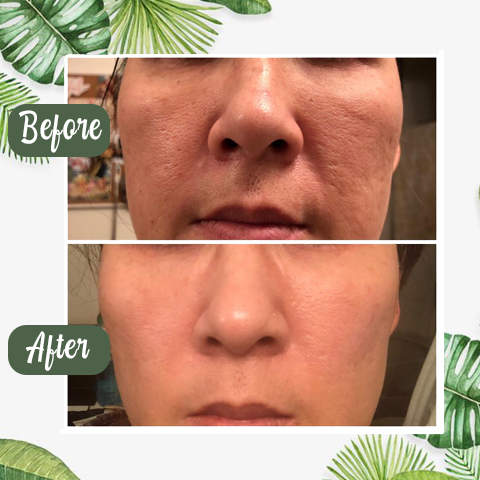 PureRadiance™ Detox Mask Stick — Instantly Clear Pores for Unstoppable Radiance and Confidence