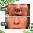PureRadiance™ Detox Mask Stick — Instantly Clear Pores for Unstoppable Radiance and Confidence