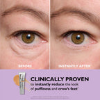 VitaLift™ — Instantly Vanish Eye Bags and Wrinkles for Unstoppable Confidence