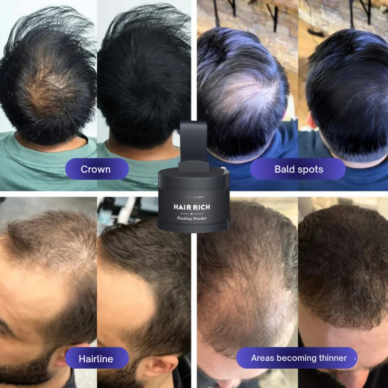 VoluMist™ — Instantly Own a Fuller, Thicker Hairline That Boosts Your Confidence All Day