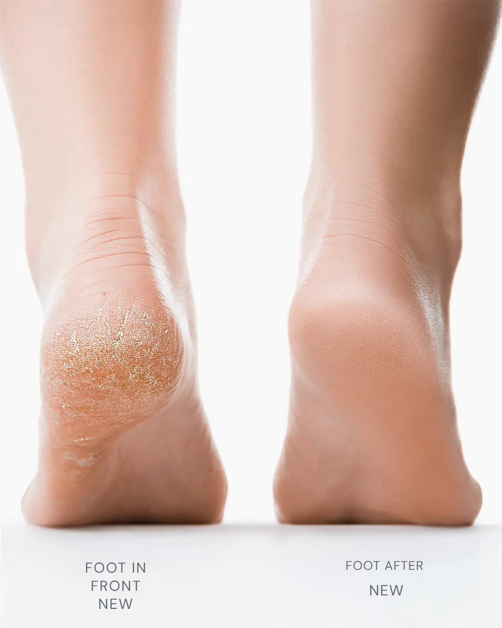 LuxiSoothe™ — Reveal Silky, Show-Stopping Feet in Minutes Without Pain or Fuss