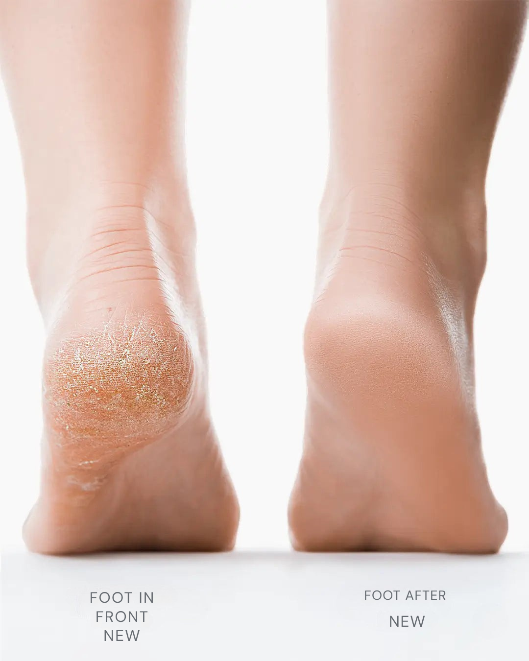 LuxiSoothe™ — Reveal Silky, Show-Stopping Feet in Minutes Without Pain or Fuss