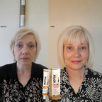 LumaVive™ — Reveal Firmer, Youthful Skin That Radiates Confidence Every Day
