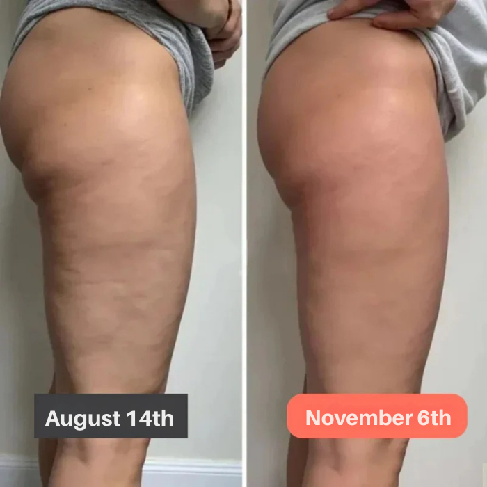 ArdentSculpt™ Leggings — Sculpt Your Dream Legs with Unstoppable Confidence and Silky Smooth Tone