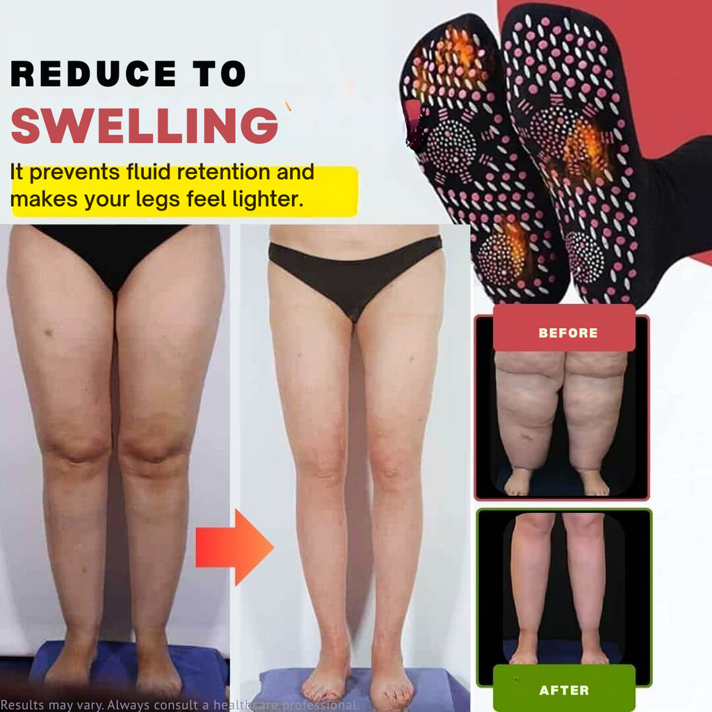 CircuEase™ — Instantly Energize Legs and Crush Pain for All-Day Freedom