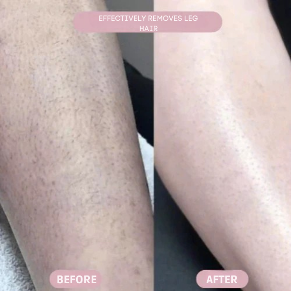 Velanni™ — Glide into Silky, Bump-Free Skin and Unstoppable Confidence