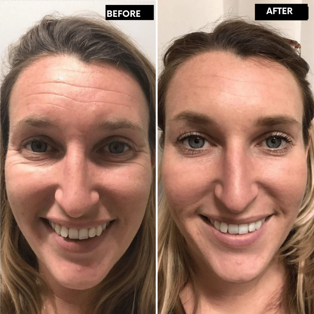 LumaFirme™ — Reveal Firmer, Radiant Skin That Turns Back Time in Just 14 Days