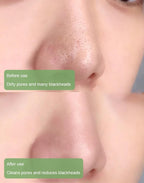 PureRadiance™ Detox Mask Stick — Instantly Clear Pores for Unstoppable Radiance and Confidence