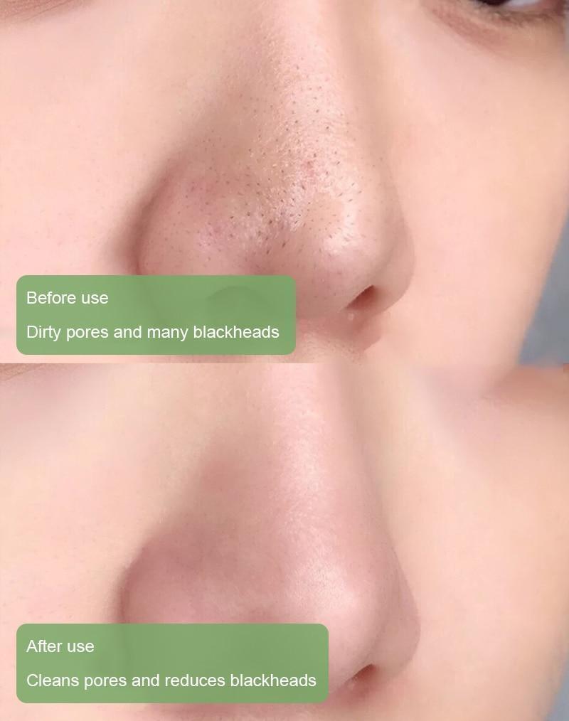 PureRadiance™ Detox Mask Stick — Instantly Clear Pores for Unstoppable Radiance and Confidence