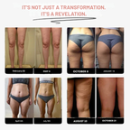 ArdentSculpt™ Leggings — Sculpt Your Dream Legs with Unstoppable Confidence and Silky Smooth Tone