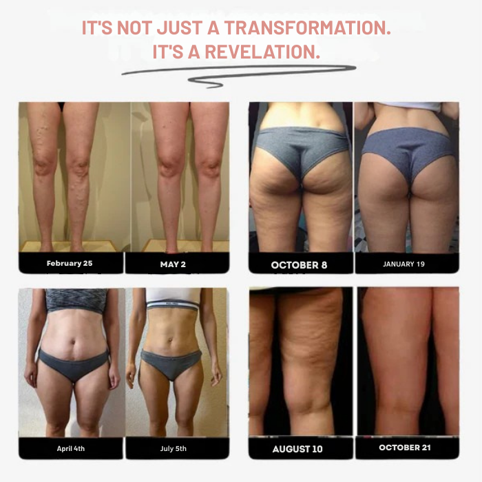 ArdentSculpt™ Leggings — Sculpt Your Dream Legs with Unstoppable Confidence and Silky Smooth Tone
