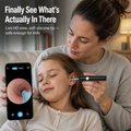 SonicSight™ — See Hidden Ear Wax Clearly and Clean with Confidence Every Time