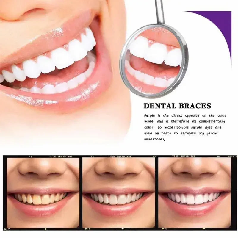 RadiantSmile™ — Instantly Ignite Confidence with Pain-Free, Dazzling Brightness