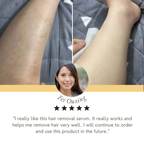 SilkSeren™ — Touch Silky Smooth Confidence, Pain-Free and Everlasting