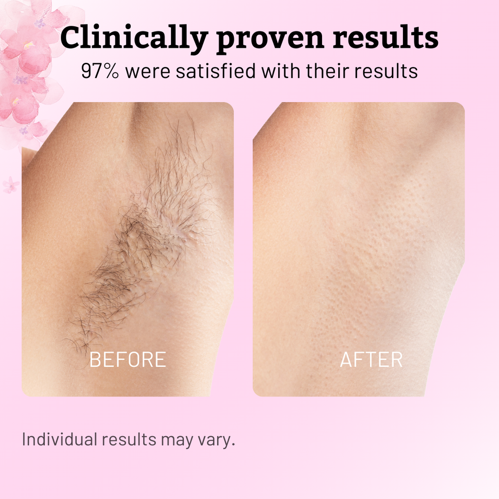 VeluDerm™ — Stop Hair Regrowth Fast and Enjoy Silky, Irritation-Free Skin Every Day