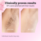 VeluDerm™ — Stop Hair Regrowth Fast and Enjoy Silky, Irritation-Free Skin Every Day