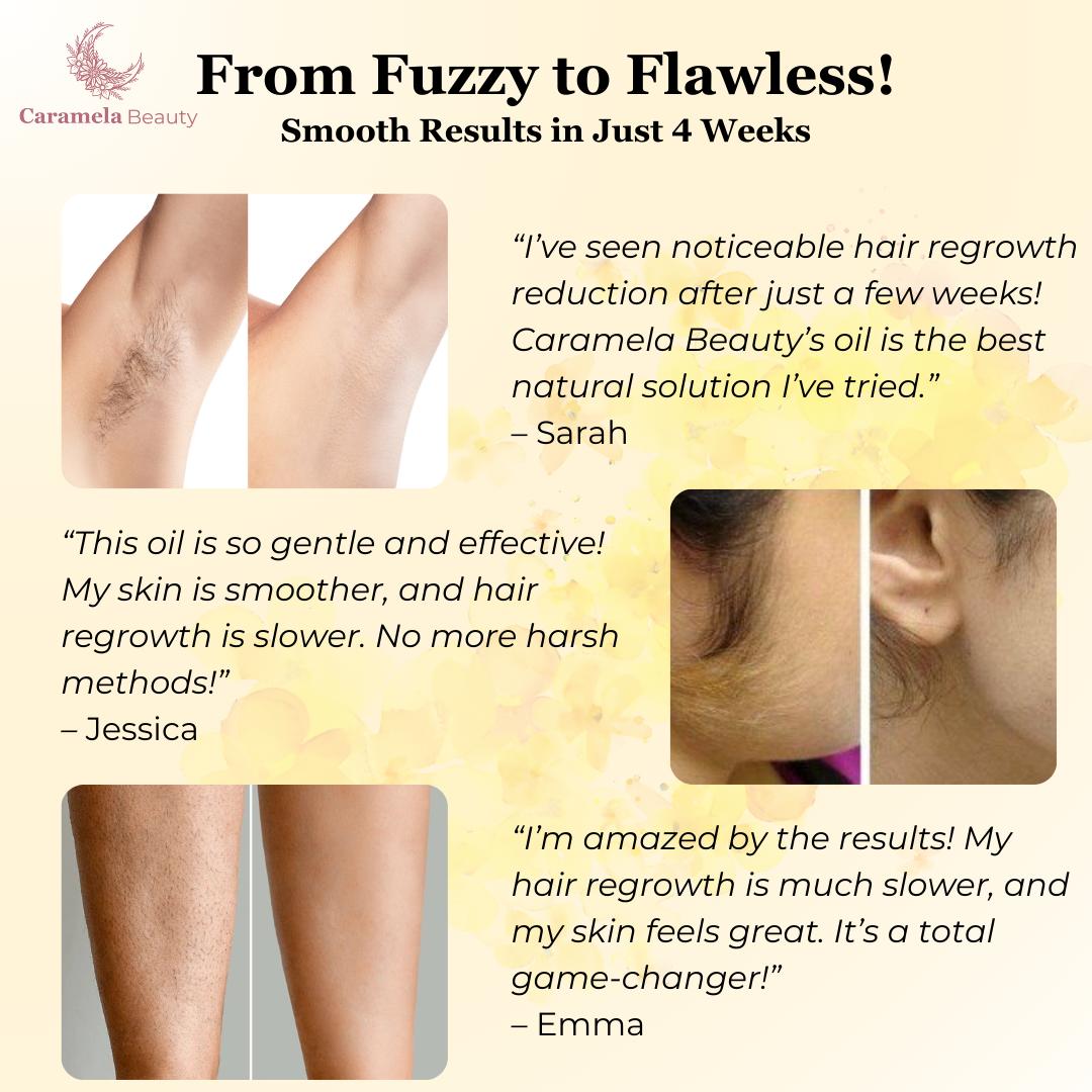 VeluDerm™ — Stop Hair Regrowth Fast and Enjoy Silky, Irritation-Free Skin Every Day