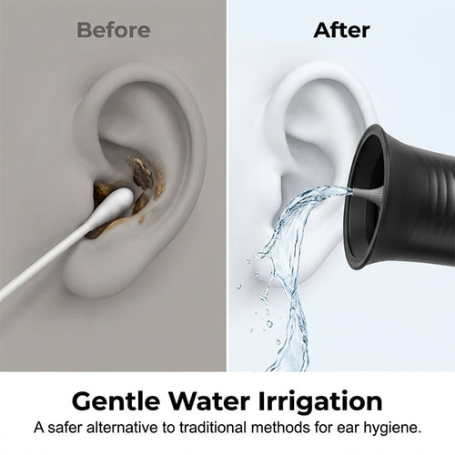 AuraFreshWave™ — Unlock Soothing, Spotless Ears That Boost Your Confidence Every Day