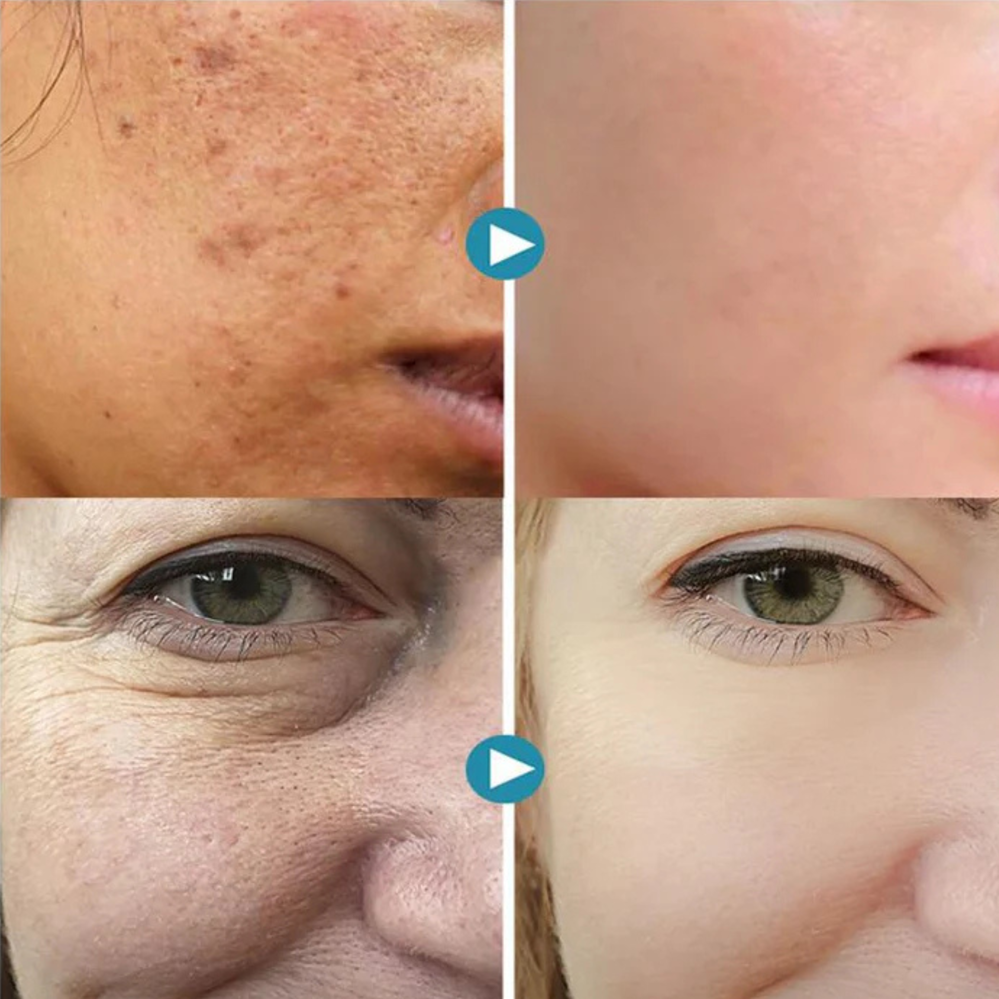 VelvetDawn™ — Unlock Irresistibly Smooth, Radiant Skin That Commands Attention