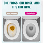 Scented Toilet Cleaning Gel | Sticky Gel Formula | Accurate Nozzle | ForestFresh