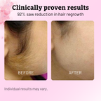 VeluDerm™ — Stop Hair Regrowth Fast and Enjoy Silky, Irritation-Free Skin Every Day