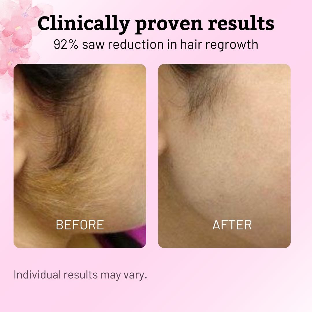 VeluDerm™ — Stop Hair Regrowth Fast and Enjoy Silky, Irritation-Free Skin Every Day