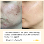 EELHOE Eternity™ — Erase Dark Spots, Reveal Glowing Skin | 1+1 FREE