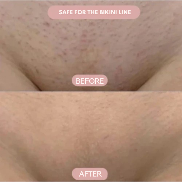 Velanni™ — Glide into Silky, Bump-Free Skin and Unstoppable Confidence