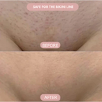 Velanni™ — Glide into Silky, Bump-Free Skin and Unstoppable Confidence