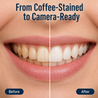 GlowAura™ — Whiten Coffee-Stained Teeth in 10 Minutes Without the Zingers